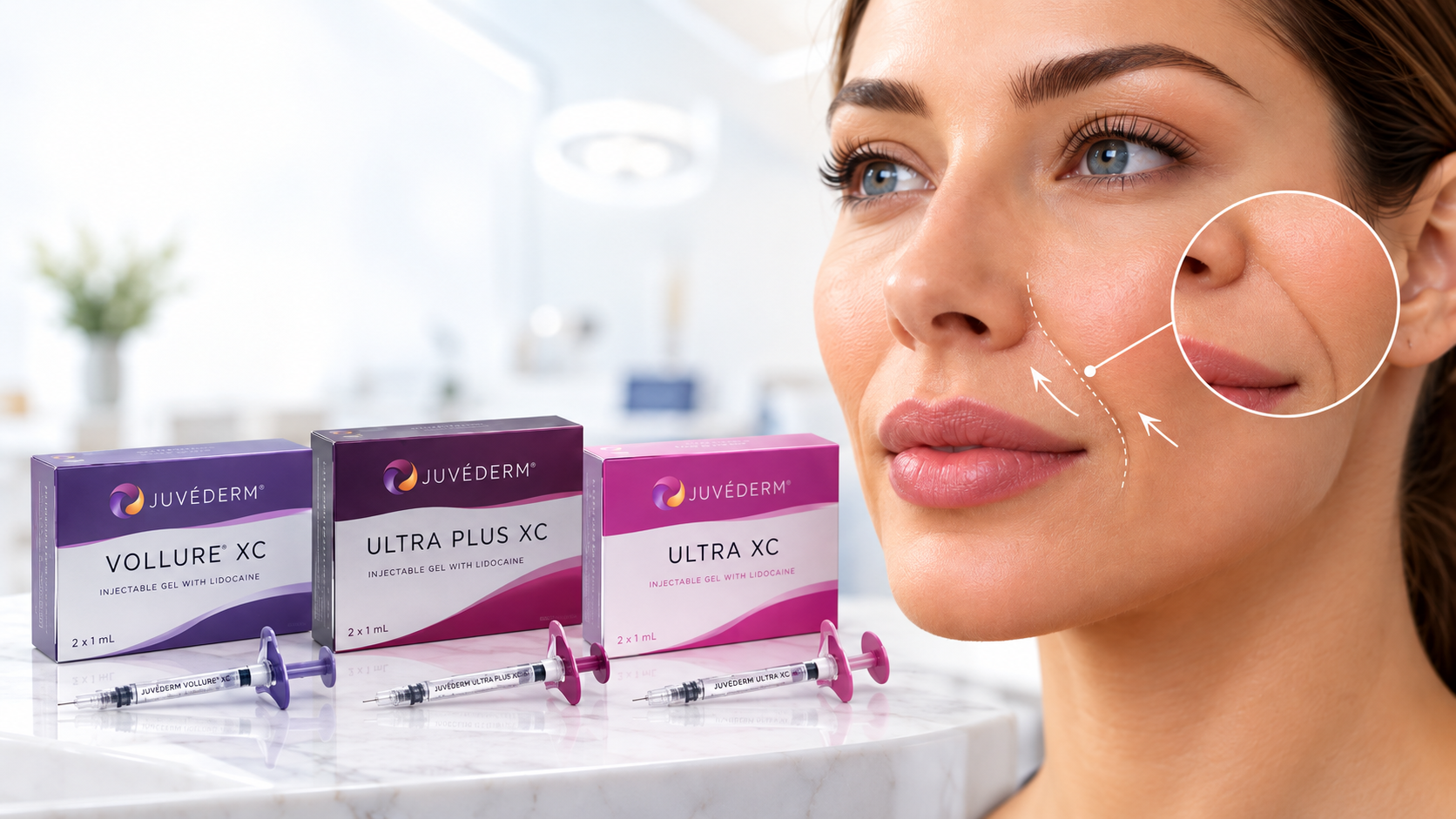 juvederm for nasolabial folds