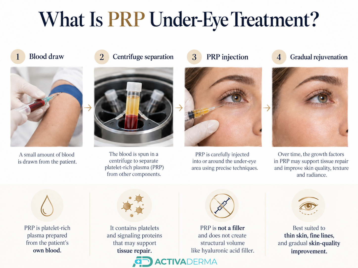 What Is PRP Under-Eye Treatment?
