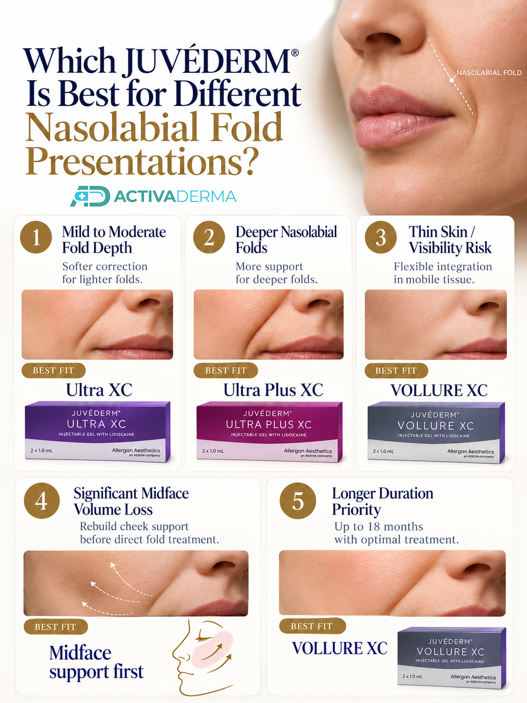 Which Juvederm filler is best for nasolabial folds